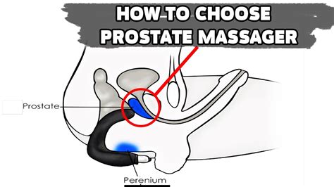 A prostate massage is sometimes used for sexual stimulation but may also provide relief to men with an enlarged prostate (bph). HOW TO CHOOSE PROSTATE MASSAGER - YouTube