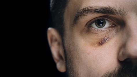 You are also the victim of crime. When Men Suffer Domestic Abuse - A&E