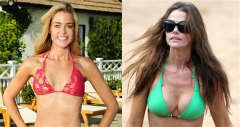 She said she was repeatedly asked to go through the body screener by an apologetic tsa agent who pointed out an anomaly over her genitals. Denise Richards Before and After Breast Implants - Simpson ...