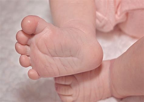 最新のファッション: トップ100+女性 股 しこり 何科