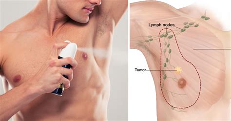 You can lay down, stand up or conduct in front of the mirror. THIS Popular Deodorant Causes Cancer And Breast Growth In ...
