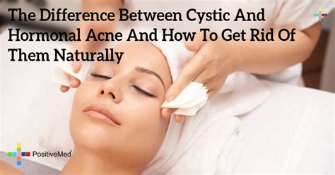 Learn the best way to get rid of acne. The Difference Between Cystic And Hormonal Acne And How To ...