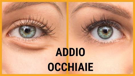 Tra le vespe infestanti è la meno aggressiva. Come eliminare le OCCHIAIE SCURE ♡ - YouTube