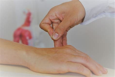 Akupunktur vücudun belirli noktalarına ince uçlu özel iğneler batırılarak yapılan tedavi; Akupunktur TCM | ACAMED Ärztezentren Dübendorf + Uster