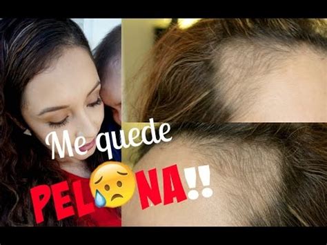 Fue atendida por paramédicos estatales y transportada vía. SE ME CAYO EL CABELLO - DEPRESIÓN - REMEDIOS - YouTube
