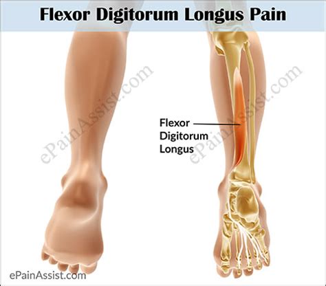 Assess the tendons along their length in longitudinal and transverse. Flexor Digitorum Longus Pain|Symptoms|Causes|Treatment