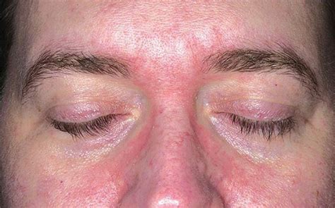 Cuci tangan dengan durasi minimal 20 detik untuk membunuh virus corona menggunakan sabun dan air bersih yang mengalir. Boleh Ke Guna Sabun Mandi Untuk Cuci Muka? Ini Penjelasan ...