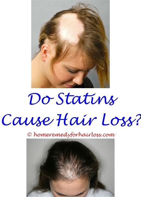 Many patients think not getting enough protein or having a vitamin or mineral deficiency is the only reason they are losing hair. Does All Radiation Cause Hair Loss - All About Radiation