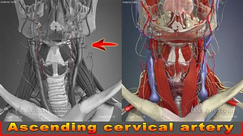 You have two common carotid arteries, one on each side of your neck, that each divide into internal and external carotid arteries. Ascending cervical artery | Arteries of head and neck | 3D ...