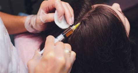 Known as a scalp sensitizer, anthralin creates an irritant reaction which stimulates the immune system and encourages hair growth. What Is Alopecia Areata: Types, Causes, Treatments And More