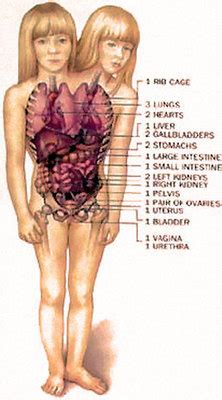 We did not find results for: How do you think conjoined twins, Abby and Brittany Hensel ...