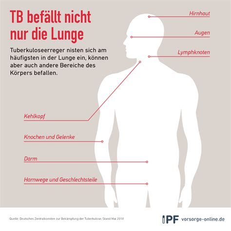 Erreger der tuberkulose ist mycobacterium tuberculosis. Tuberkulose