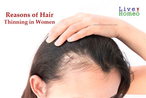 This is because, without enough vitamin c, the absorption of iron from foods such as red meat becomes more difficult. Reasons of hair thinning in women | Live Homeo | Live Homeo