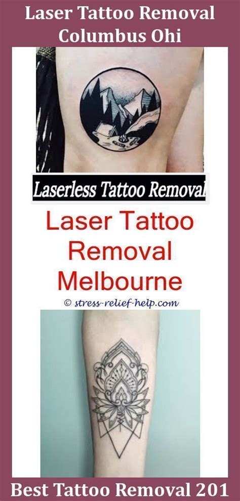 Removing a tattoo with removal creams may take a while as the tattoo will be removed bit by bit but it won't cost you that as much as the other options. Tattoo Removal Sydney,fast tattoo removal tattoo removal cream name red tattoo removal before ...