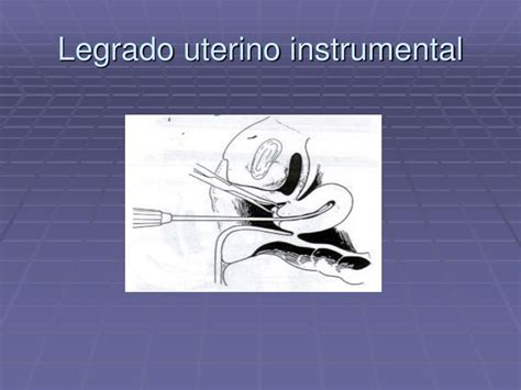 Los diagnósticos histológicos del legrado. PPT - SANGRADOS I TRIMESTRE DEL EMBARAZO PowerPoint ...