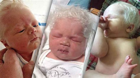 In hungary, a baby boy was born with silver white hair on full head, which has left the doctors and when baby bence was born in hungary, he was weighing 5400 grams (11.90496 pounds) that had. The Truth Behind This White-Haired Baby - Bon Voyaged