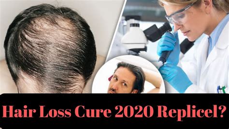 Cure for hair loss coming soon. 👨🏼‍🦲Hair Loss Cure Coming in 2020? - YouTube