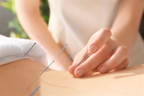 Acupuncture Points for Anxiety for a Better Quality of Life