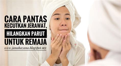 Tips dan cara menghilangkan jerawat secara mudah, murah, cepat semalam, efektif dengan cara dan bahan alami untuk wajah remaja, dewasa, muda. Kecutkan jerawat & hilangkan parut bagi remaja/student ...