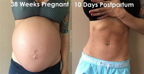 Maybe you would like to learn more about one of these? HOW TO TIGHTEN LOOSE SKIN AFTER WEIGHT LOSS OR HAVING A BABY - Diary of a Fit Mommy