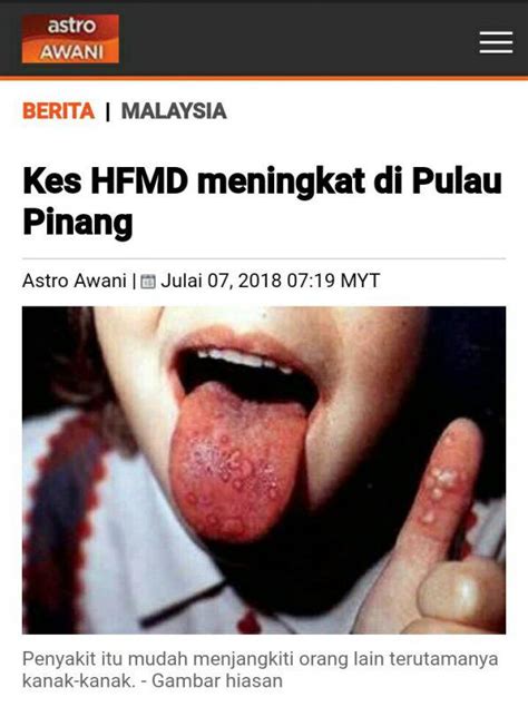 Jika kesihatan seseorang berada pada tahap yang tidak baik, maka pelbagai perkara akan tergendala. Kes HMFD Meningkat di Pulau Pinang. Premis Penjagaan Kanak ...