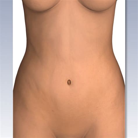 How many months do women carry a baby? Female Abdominal Anatomy - External View - TrialExhibits Inc.