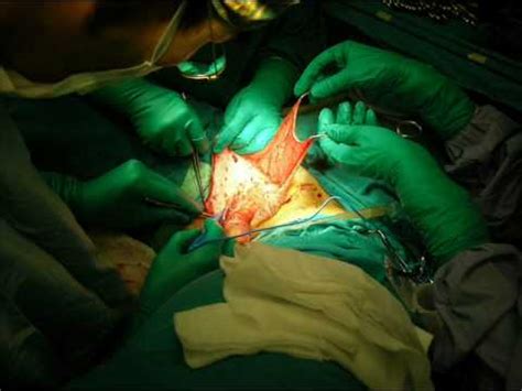 We did not find results for: Gender Reassignment Surgery - YouTube