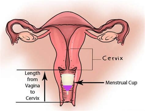 250+ coins, margin trading, derivatives, crypto loans and more. How to Choose Best Menstrual Cup for a Low Cervix and High ...