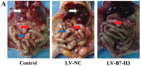This can help you put your own cancer risk into perspective. B7-H3 overexpression in pancreatic cancer promotes tumor ...