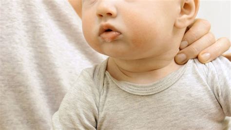 Benjolan Tulang Di Tengah Dada Bayi - Siti