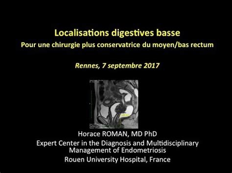 L'endométriose est une maladie gynécologique fréquente qui concerne une femme sur dix. Chirurgie de l'endométriose digestive basse: pour une ...