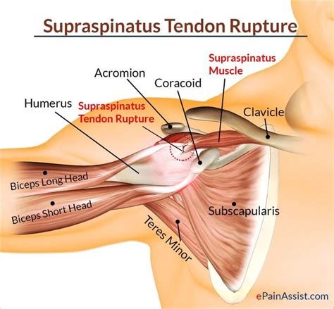 The deltoid, supraspinatus, infraspinatus, teres minor, teres major, and subscapularis arise from the scapula and are inserted into the humerus. Diagram Of Shoulder Tendons Muscles Ligaments And Tendons Of The Human Back Nerd Pinterest ...