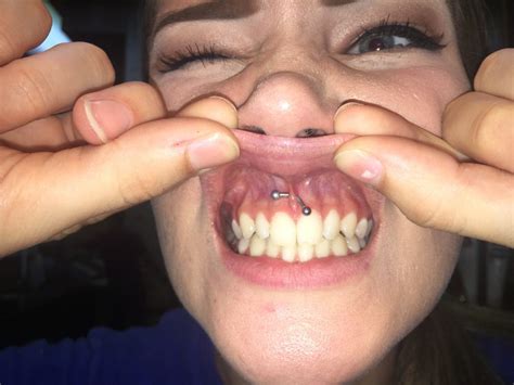 The worst part is usually when you first get the piercing done, although tears and sores can happen at any time. Tongue & Lip Piercings: Effect On Your Oral Health | Six ...