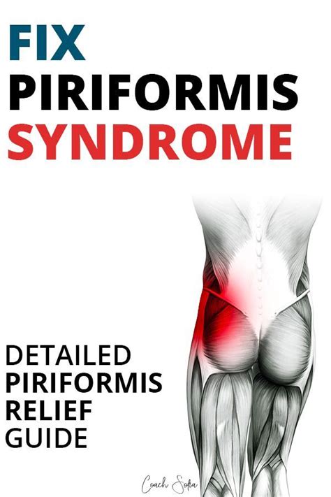 This article provides an overview of piriformis syndrome causes and symptoms, including who it affects and how it affects the body. How To Fix Piriformis Syndrome (Detailed Recovery Guide ...