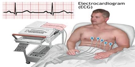 If you want to put your ecg interpretation knowledge to the test, check out our ecg quiz. Electrocardiogram - Assignment Point