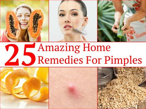Our brethren on the right are just as quick to hold up president obama's seeming lack of. 25 Amazing Home Remedies For Pimples (With images) | Home ...