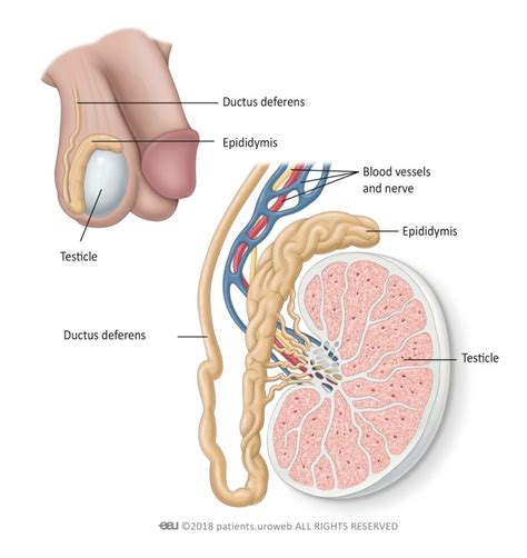 Testicular cancer is one of the types that can be diagnosed in the early stages. Testicular cancer - PI