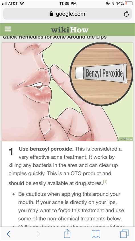 This helps to prevent pores from becoming clogged and leading to acne lesions. Pin by Lexie Lou on Face care | Effective acne treatment ...