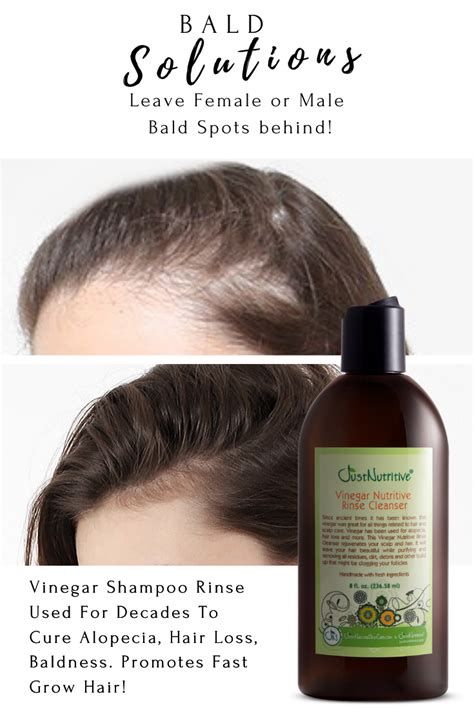 Hair loss shampoos are an excellent addition to any hair loss prevention regime. Vinegar Nutritive Rinse Cleanser | Vinegar nutritive rinse ...