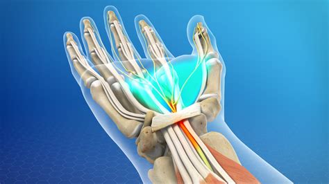 Tangan kebas hingga kaki kebas sering anda rasakan? Carpal Tunnel Syndrome | Klinik Nyeri dan Tulang Belakang