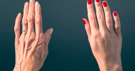 Wrinkles and baldness 'can be reversed' as scientists ...