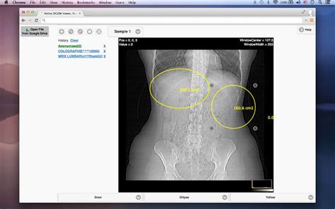 Maybe you would like to learn more about one of these? DICOM Medical Image Reader - Chrome Web Store