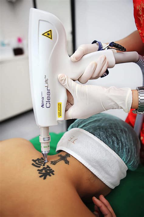 This speed and heat is crucial. Laser Tattoo Removal - Rejuvie Clinic