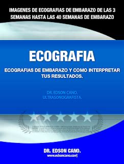 Perdida de liquido amniotico pizca a menudencia. EDSONGCANO: Porqué Disminuye El Líquido Amniótico En El ...