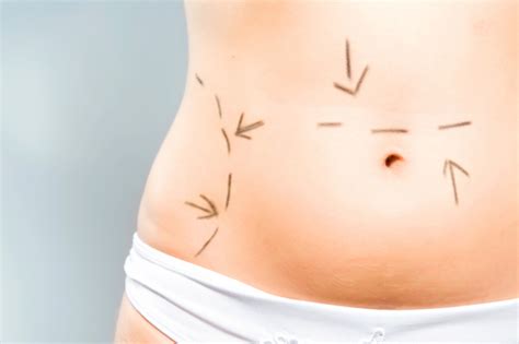 Ainsi, pour une abdominoplastie, il faut bien choisir une clinique digne qui respecte les normes, doter des installations y afférentes à une opération chirurgicale. Chirurgie esthétique : abdomen - Combien coûte une ...