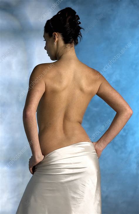Some images are hidden because they can no longer be found or have been removed by the file host. Woman's back - Stock Image - P700/0382 - Science Photo Library