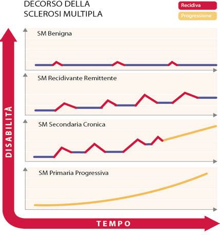 Come capire e affrontare la patologia, come accedere a risorse e servizi, come vivere con la sm. la Sclerosi multipla .. Ccsvi vista da SAM, e non solo: