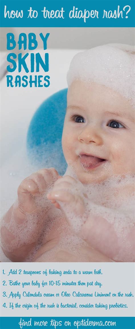 How will i know if i have a stye? How Long Does it Take for a Diaper Rash to Go Away?