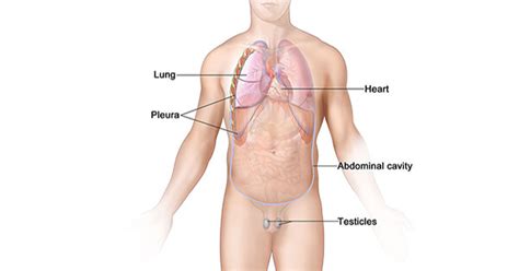 In addition to the costs directly associated with mesothelioma treatments, patients and their loved ones will also be required to cover a whole host. Malignant Mesothelioma—Patient Version - National Cancer ...