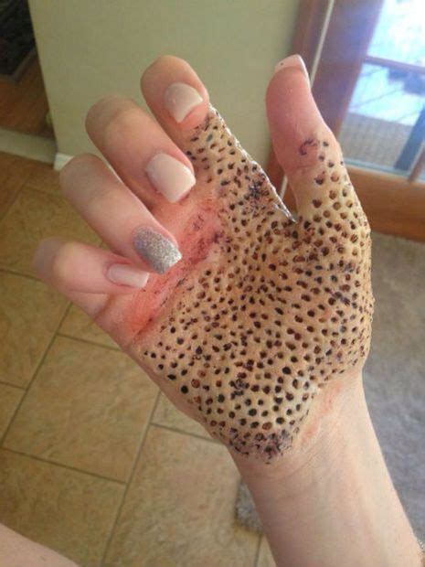 Trypophobia is a condition where a person experiences a fear or aversion to clusters of small holes. Trypophobia | Opposite of tripaphobia | Pinterest